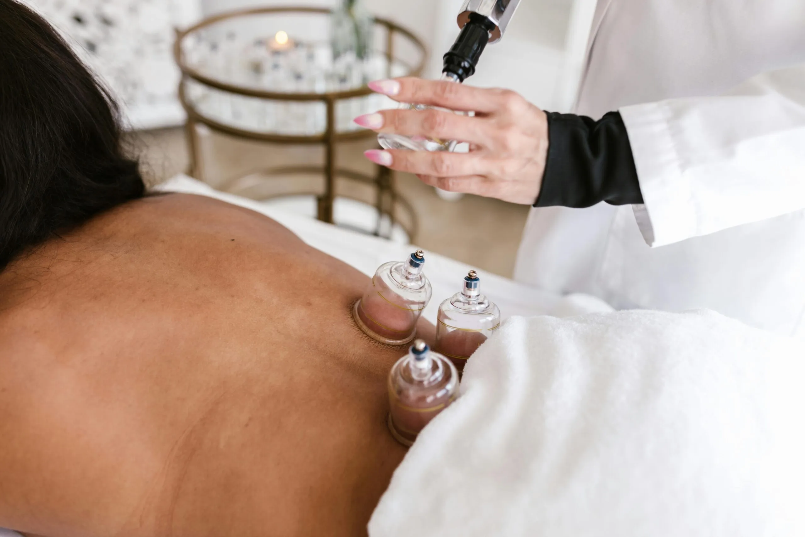 Cupping Therapy — MBS Remedial Massage Sydney